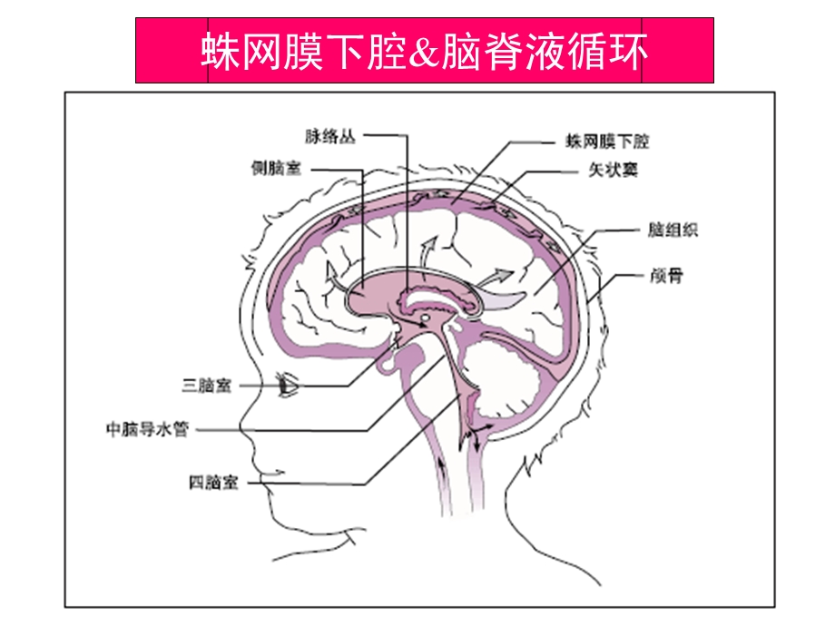 珠江医院蛛网膜下腔出血.ppt_第2页