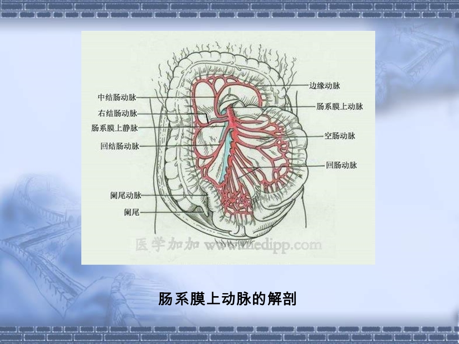 肠道缺血性疾病的CT诊断.ppt_第3页