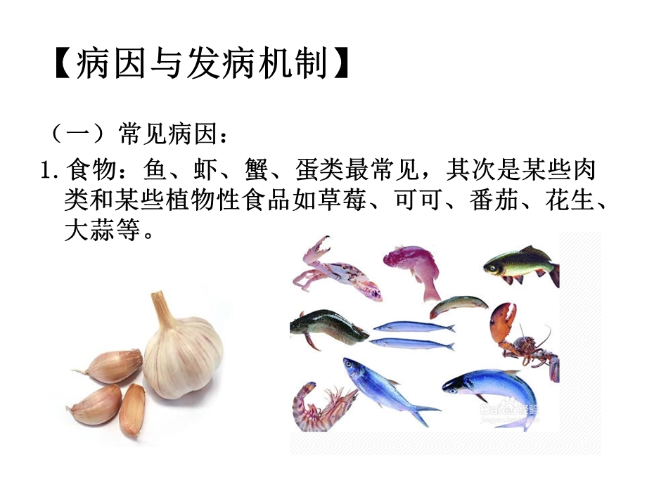 荨麻疹病人的护理.ppt_第2页