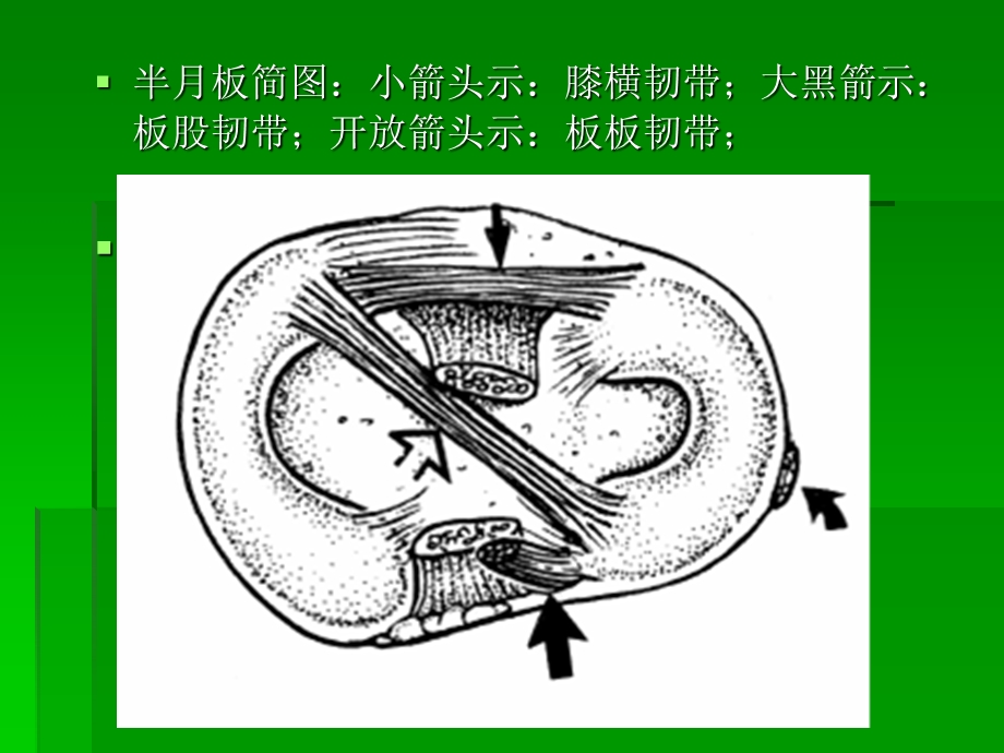 膝关节MRI解剖及损伤.ppt_第3页