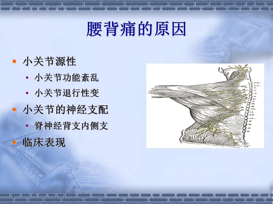 腰背痛神经阻滞疗法.ppt_第3页