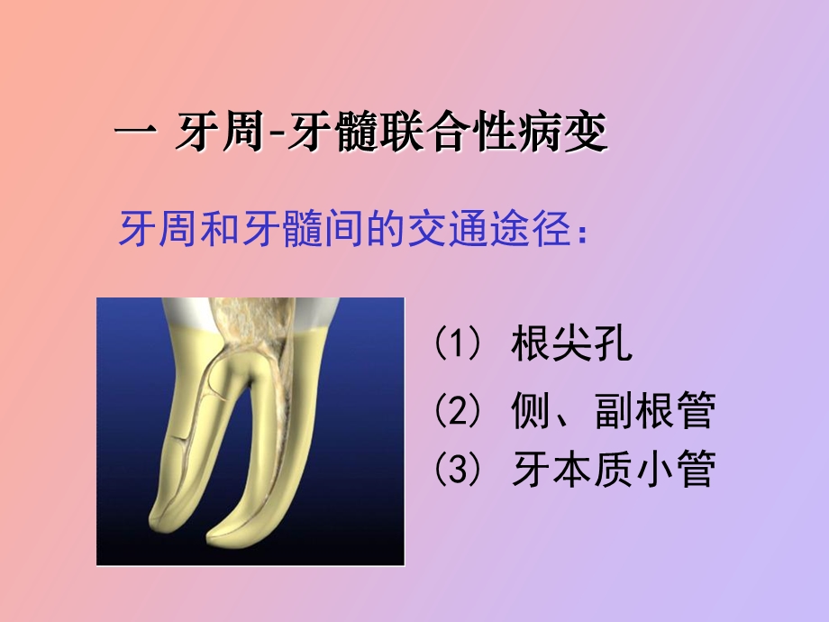 牙周炎伴发病变牙周病治疗.ppt_第2页