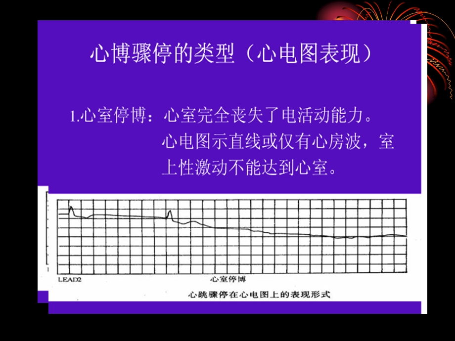 电除颤基本知识和操作流程.ppt_第3页