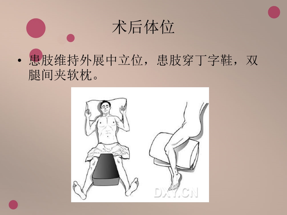 股骨颈骨折术后功能锻炼方法.ppt_第2页