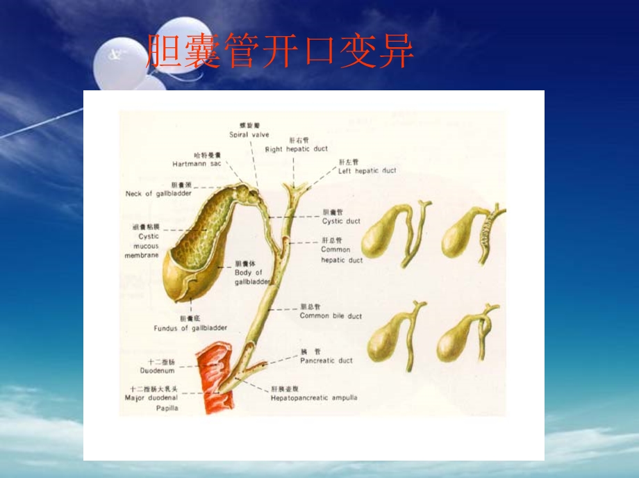 胆囊结石伴胆囊炎.ppt_第3页