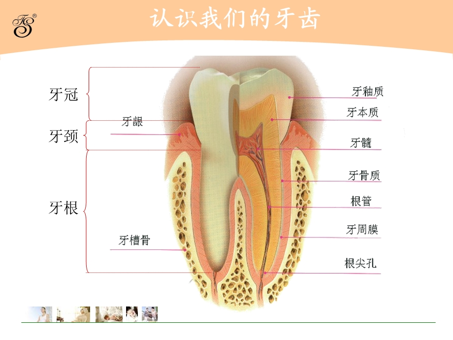 【经典资料】全国爱牙日资料牙齿常见病的防治及牙齿保健知识.ppt_第2页