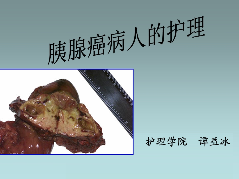 胰腺癌病人的护理.ppt_第1页