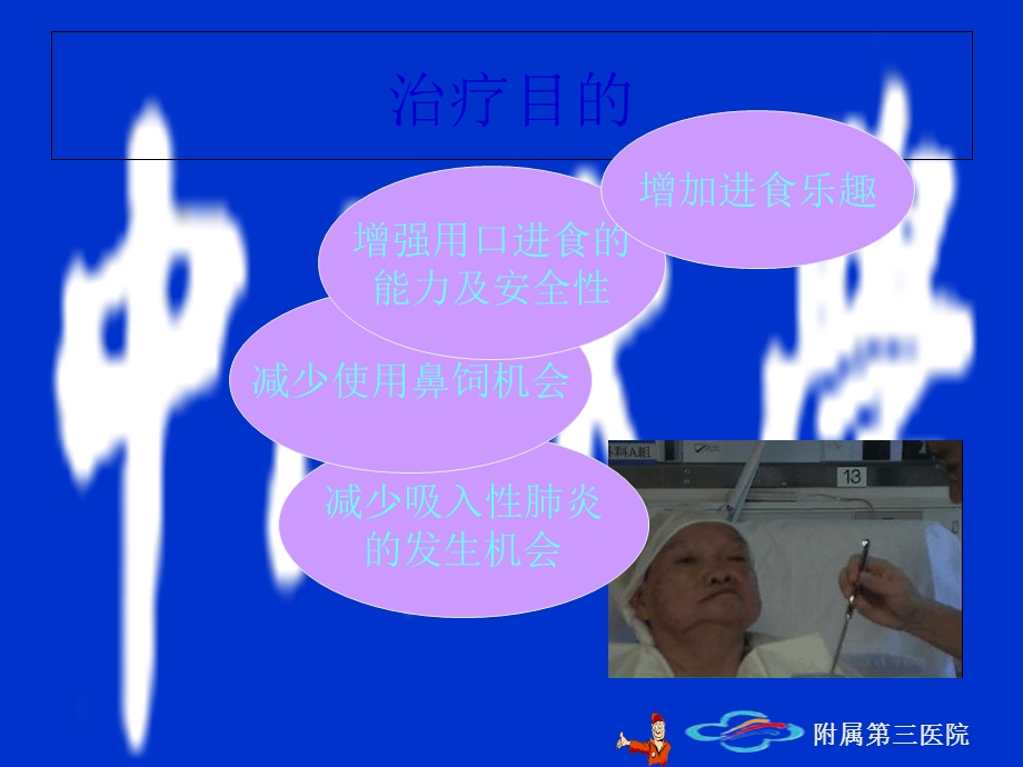 神经性吞咽障碍的治疗.ppt_第2页