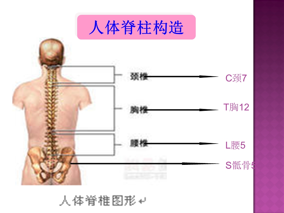 腰椎间盘突出症护理.ppt_第3页