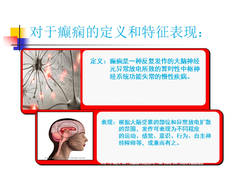 癫痫护理和急救(正式).ppt_第3页