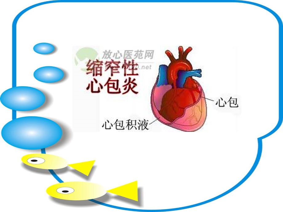 缩窄性心包炎的麻醉.ppt_第2页