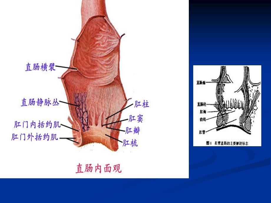 痔疮病人的护理.ppt_第3页