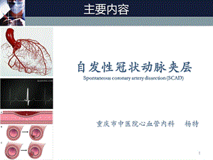 自发冠脉夹层诊疗指南解读.ppt