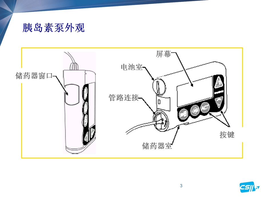 胰岛素泵的操作.ppt_第3页