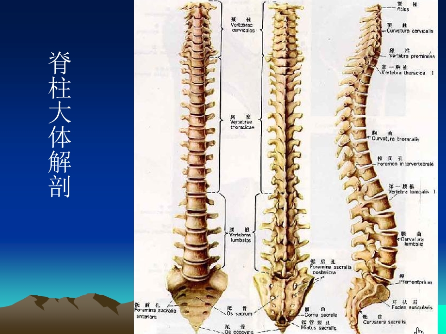 脊柱外伤影像学表现.ppt_第2页