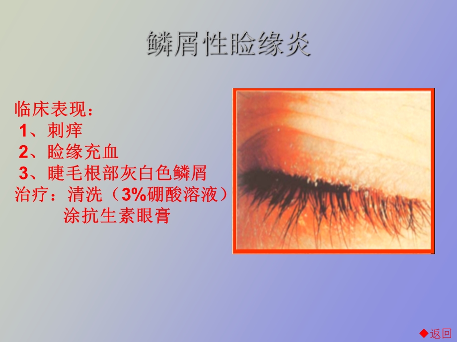 眼睑病与泪器病.ppt_第3页