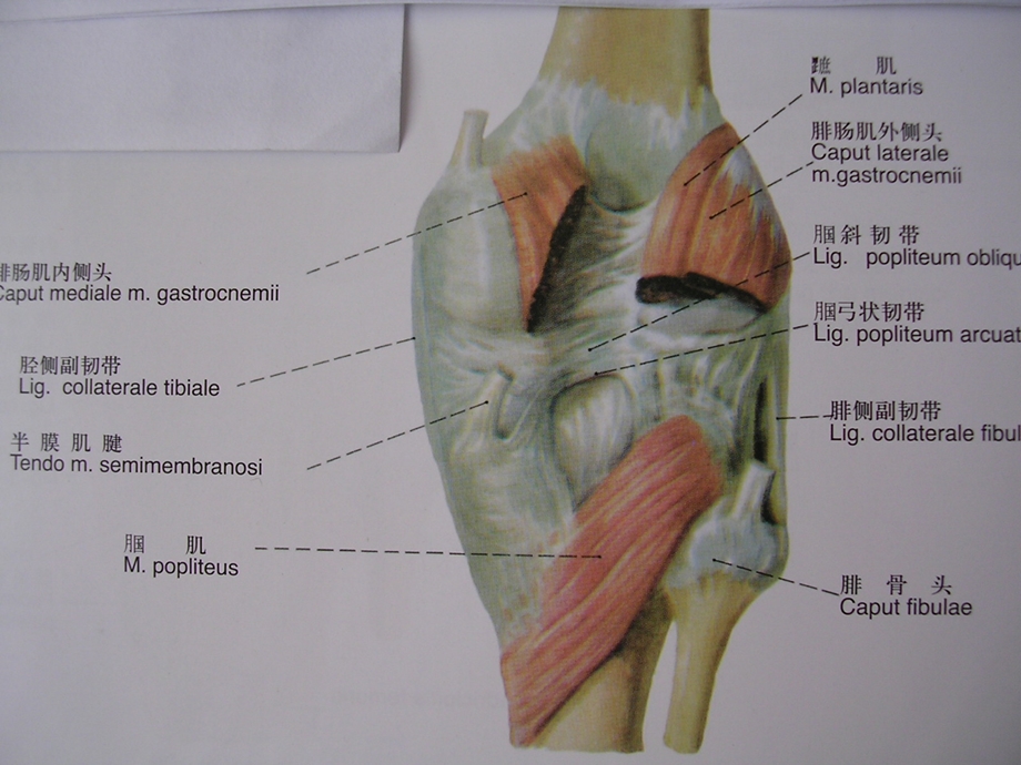 膝关节滑膜病MRI.ppt_第3页