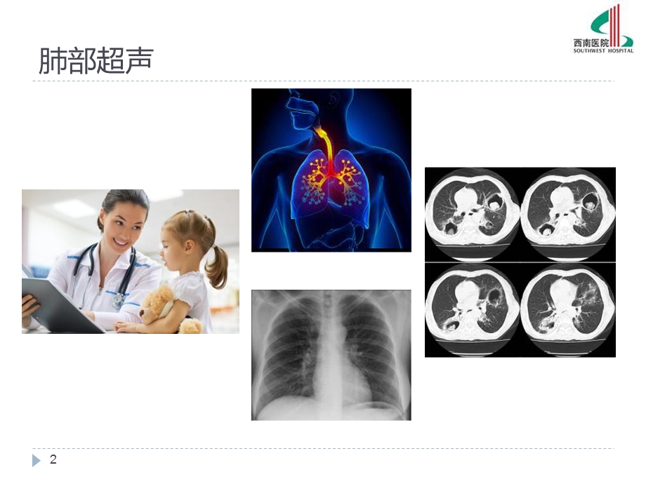 肺部超声的临床应用.ppt_第2页