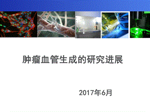 肿瘤血管生成的研究进展.ppt