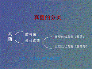 真菌感染小结.ppt