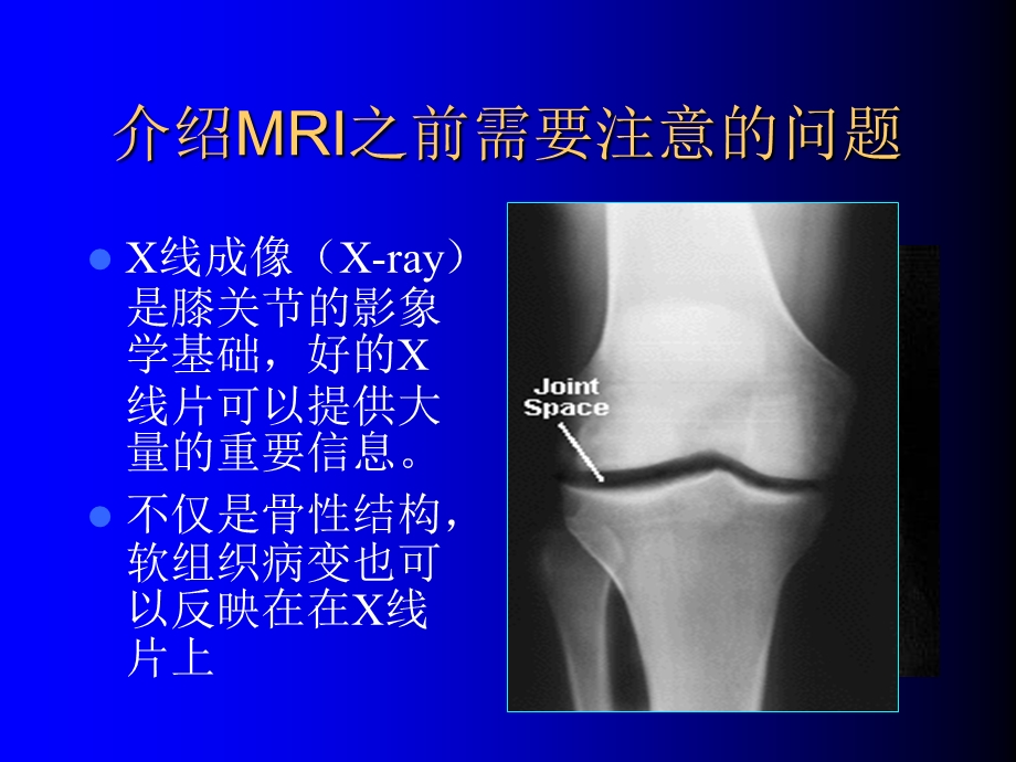 膝关节核磁共振图像阅片.ppt_第2页