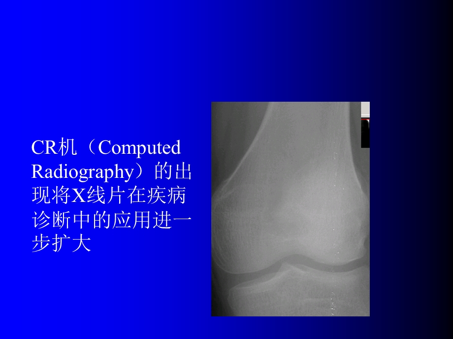 膝关节核磁共振图像阅片.ppt_第3页