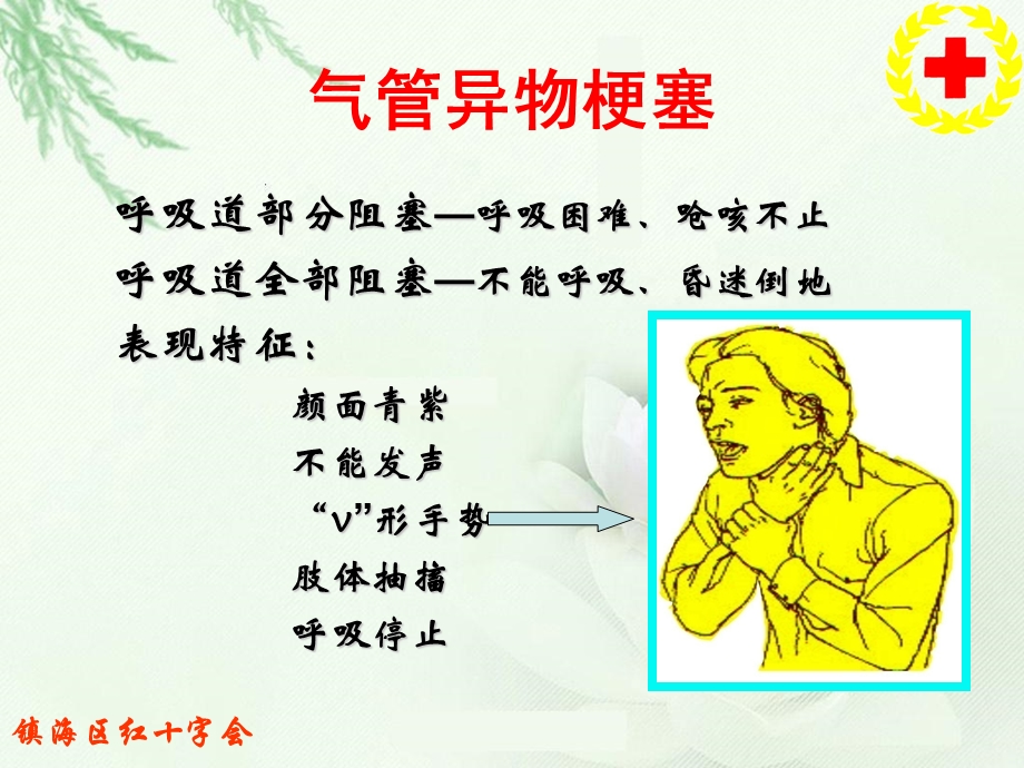 现场应急救护知识讲座老年人.ppt_第3页