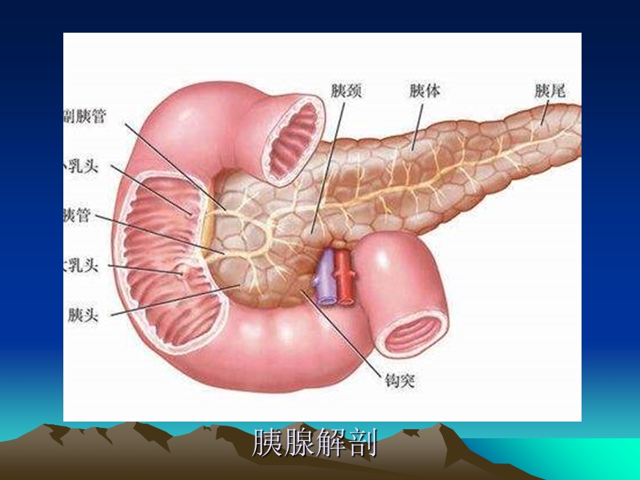 胰腺的超声诊断.ppt_第3页