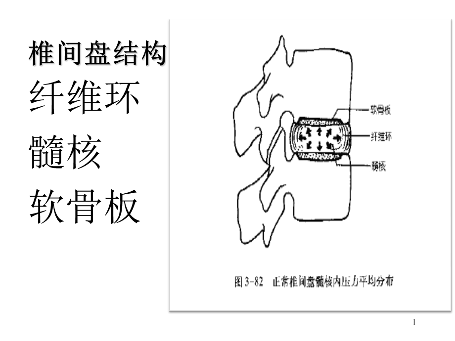 腰椎间盘突出症微创介入治疗课件.ppt_第1页