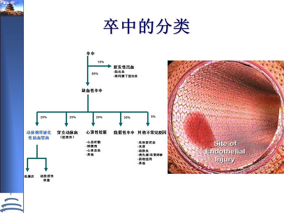 缺血性卒中的诊断策略(王拥军).ppt_第3页