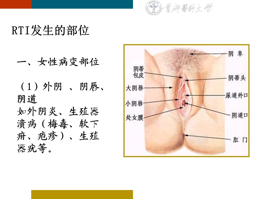 生殖道感染和性传播感染.ppt_第3页