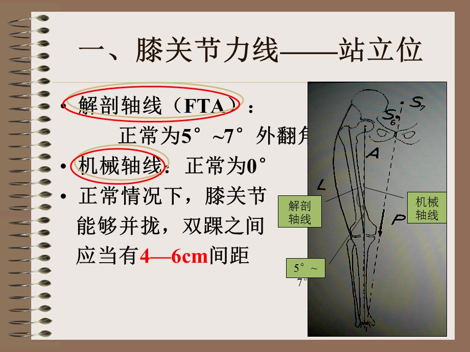 膝关节的体检方法.ppt_第3页