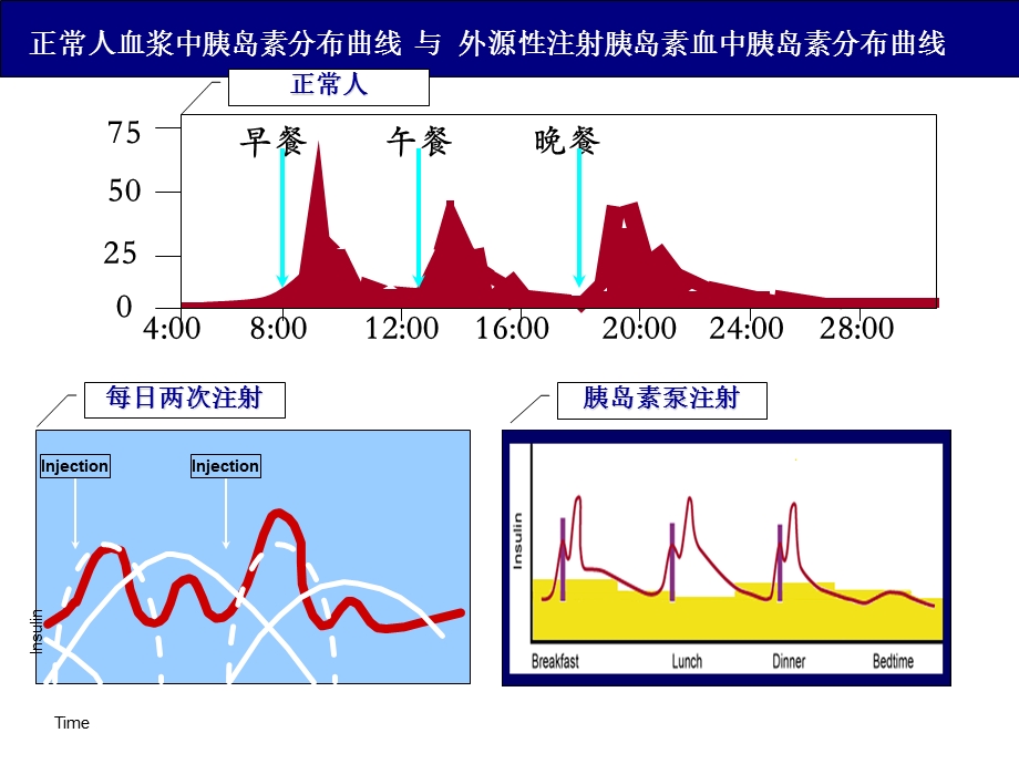 胰岛素泵-血糖调整三步法.ppt_第3页