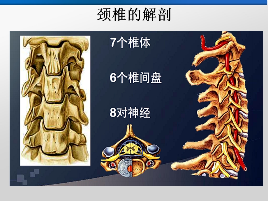 盘源性颈背及上肢疼痛.ppt_第3页