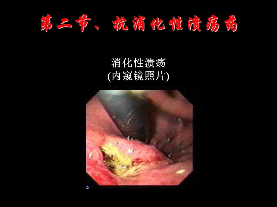 药理学28消化系统用药.ppt_第3页