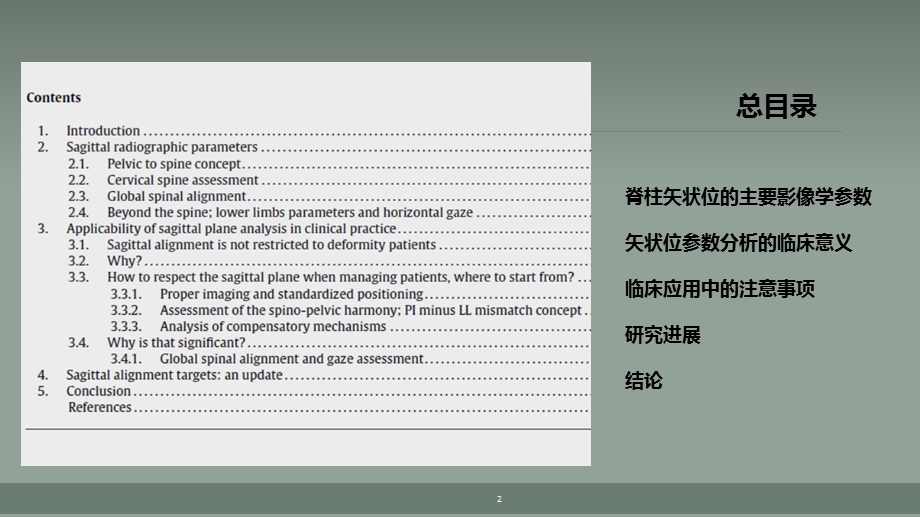 脊柱矢状位影像学参数及临床意义.ppt_第2页