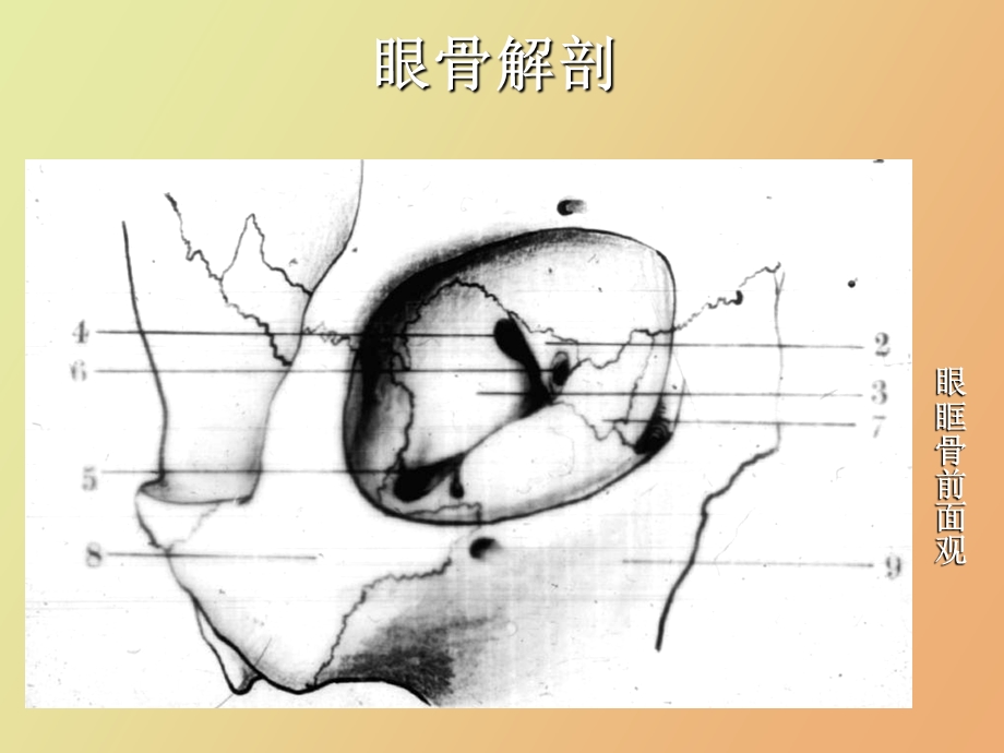 眼部疾病影像学诊断.ppt_第2页