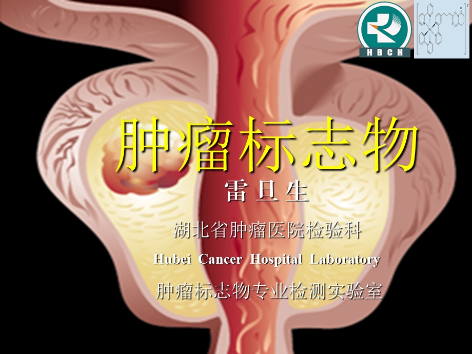 肿瘤标志物CancerMarker.ppt_第1页