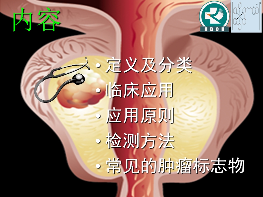 肿瘤标志物CancerMarker.ppt_第2页