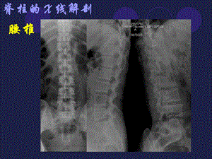 腰椎影像解剖学.ppt