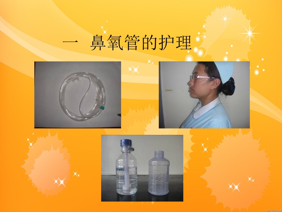 直肠癌术后各种管道护理.ppt_第3页