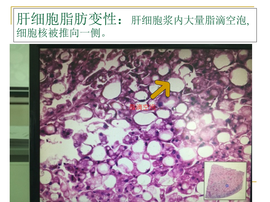 病理学实验切片考试图片.ppt_第2页