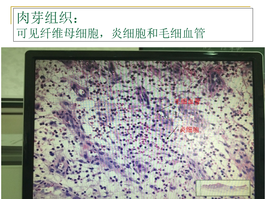 病理学实验切片考试图片.ppt_第3页