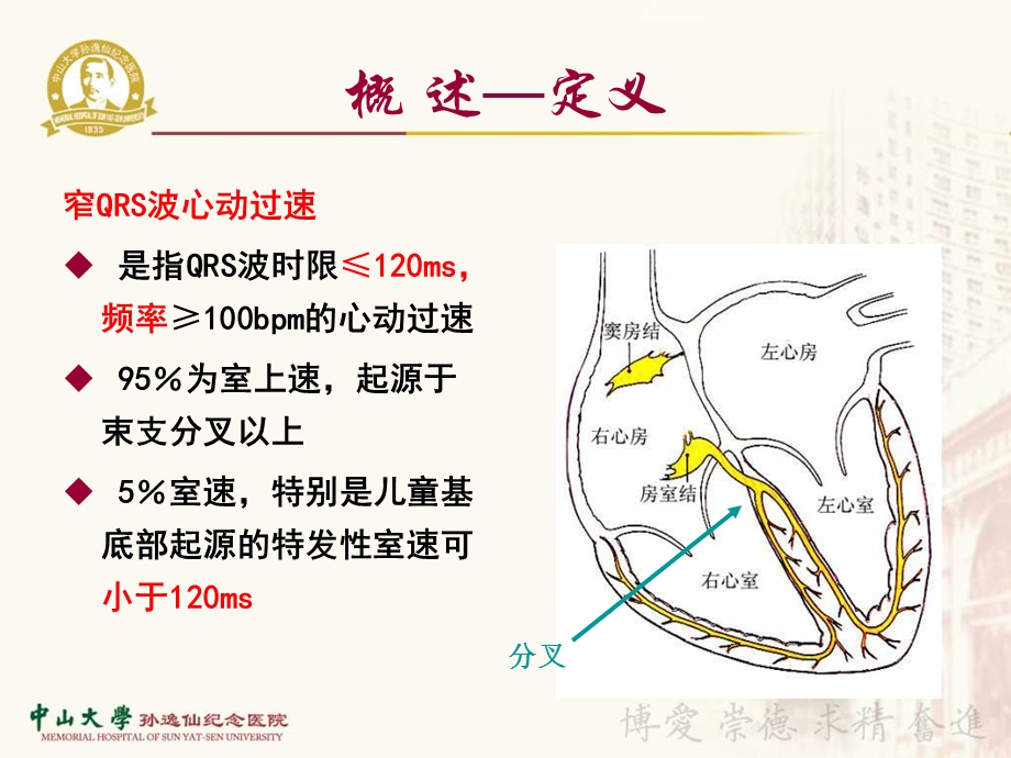 窄QRS波心动过速鉴别诊断.ppt_第2页