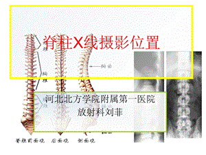 脊柱X线摄影技术.ppt