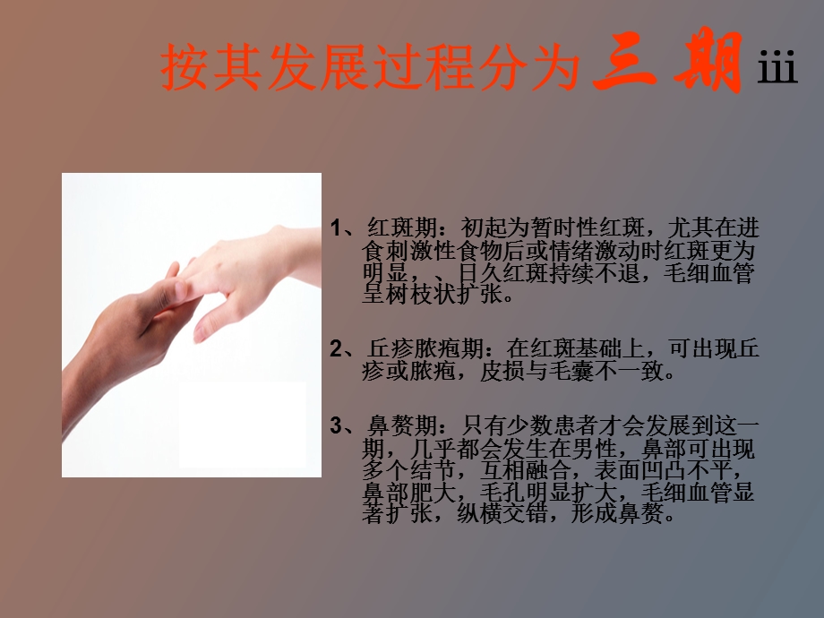 药店常见皮肤疾病用药下.ppt_第3页