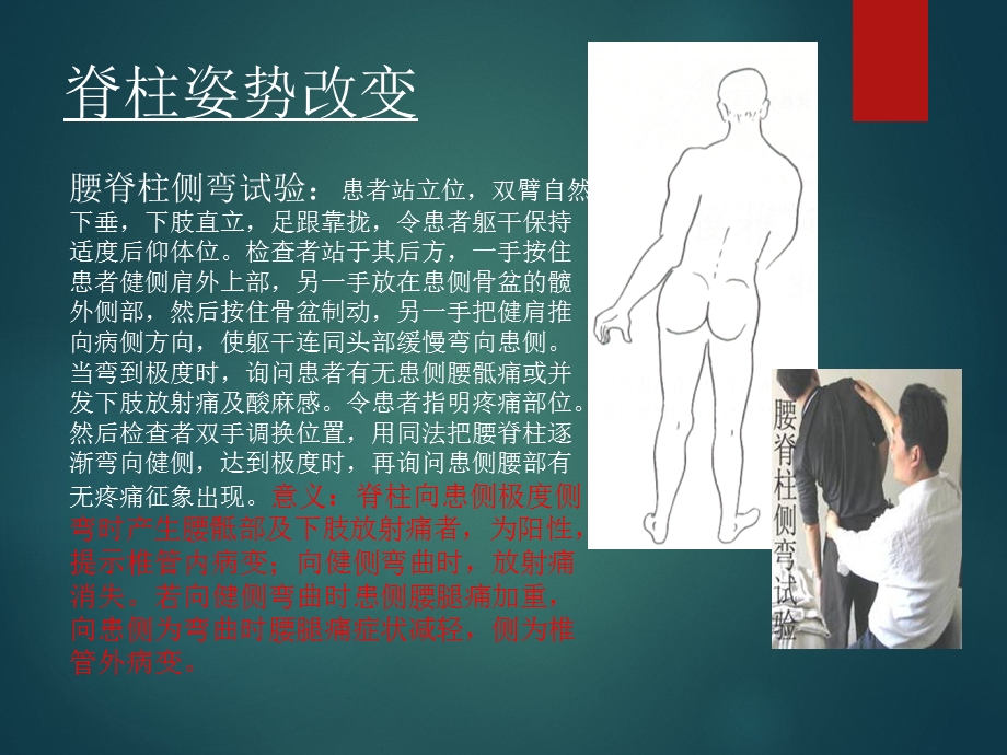 腰椎体格检查.ppt_第3页