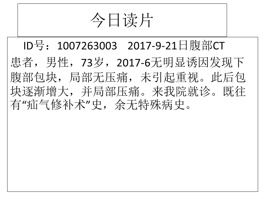 腹膜后脂肪肉瘤影像学表现与鉴别诊断.ppt_第1页