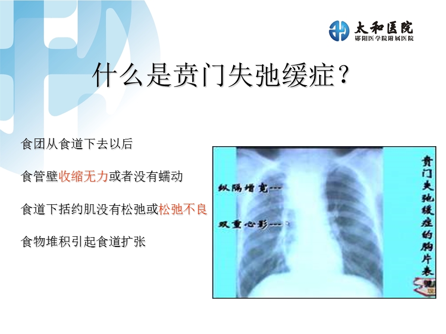 贲门失弛症.ppt_第3页