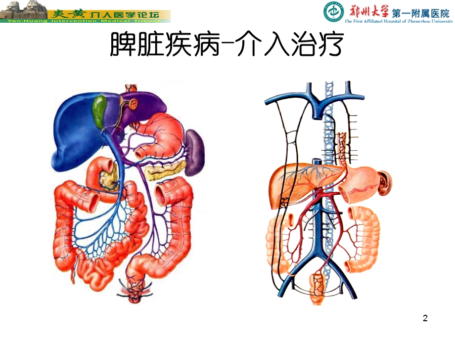 脾脏的介入栓塞治疗.ppt_第2页